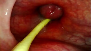 EXTREME ANAL POV CAMERA INSIDE HER ASSHOLE AS I POUND