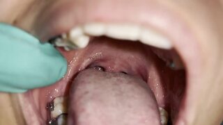 Uvula fetish